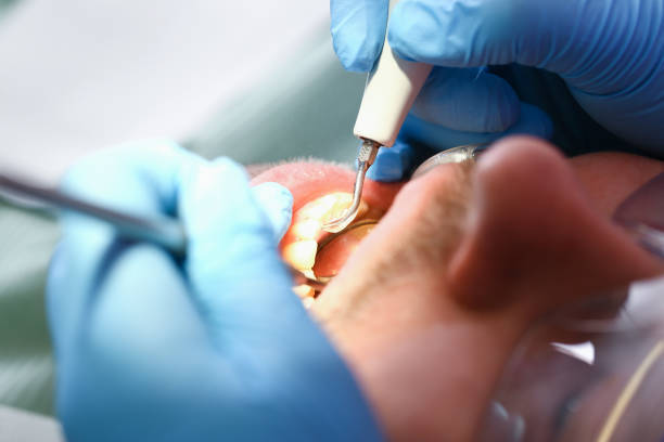 Best Tooth Infection Emergency Dentist  in Colfax, CA