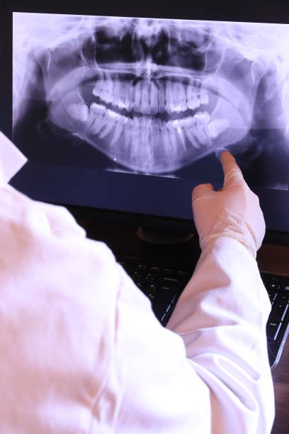Best Chipped Tooth Repair Near Me  in Colfax, CA