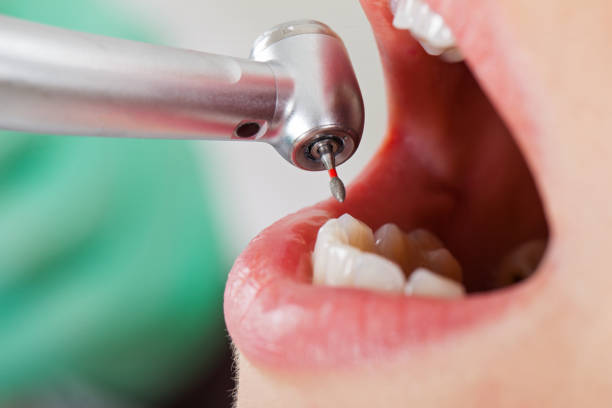 Best Tooth Pain Emergency Relief  in Colfax, CA